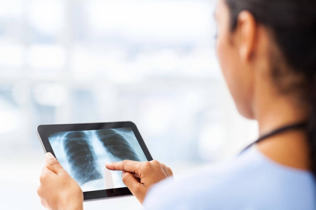 Eine Frau hält ein Tablet mit einer Röntgenaufnahme in den Händen.