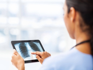 Eine Frau hält ein Tablet mit einer Röntgenaufnahme in den Händen.