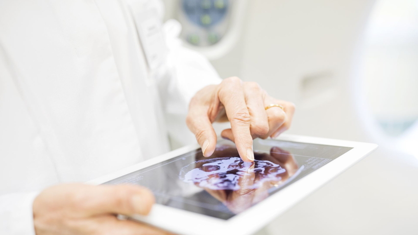 Tablet mit Röntgenbild, das von einer Person in einem weißen Kittel in den Händen gehalten wird